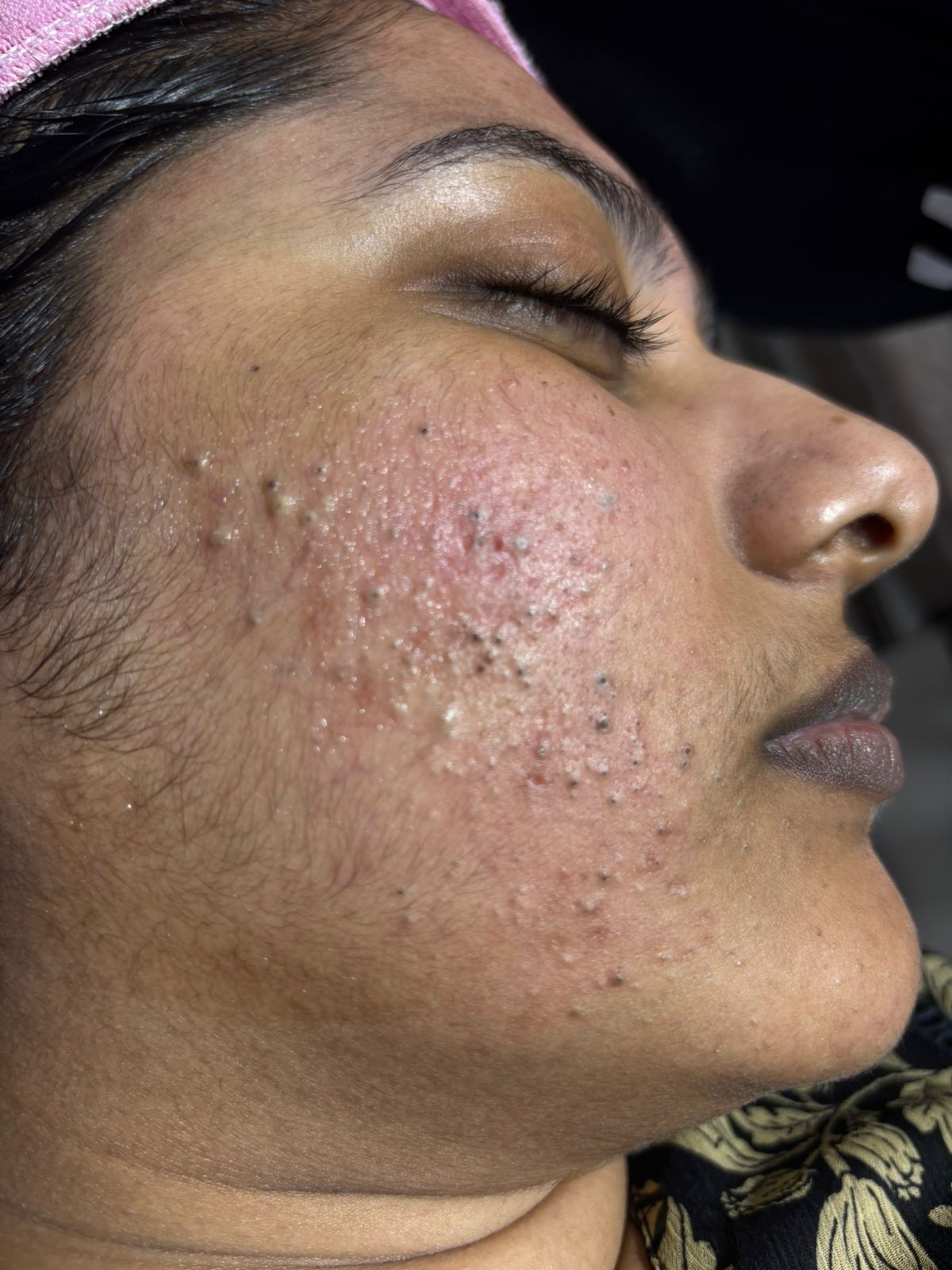 Advanced Treatment Room