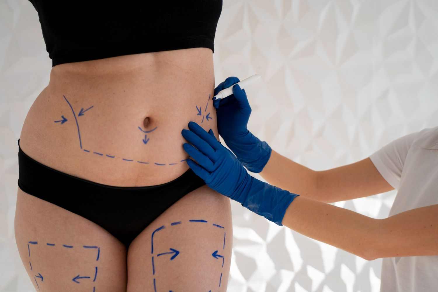 Non-Surgical Body Contouring