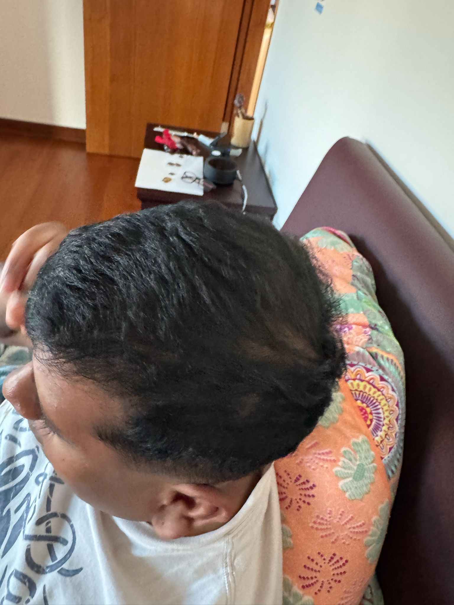 Laser Treatment Area